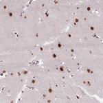 Znf672 Antibody in Immunohistochemistry (Paraffin) (IHC (P))