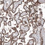 MXRA8 Polyclonal Antibody