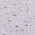 TMEM8C Polyclonal Antibody