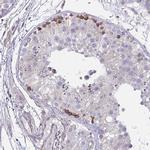 TMEM8C Antibody in Immunohistochemistry (IHC)