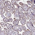 TMEM8C Antibody in Immunohistochemistry (IHC)