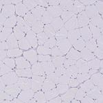 TMEM8C Antibody in Immunohistochemistry (IHC)