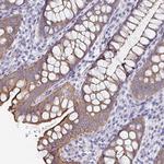 UNKL Polyclonal Antibody