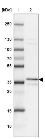 UNKL Antibody in Western Blot (WB)