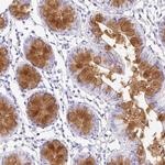 SERPINE3 Polyclonal Antibody