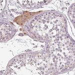 PRSS38 Polyclonal Antibody
