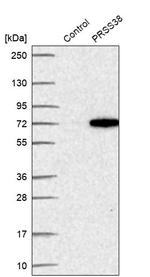 PRSS38 Antibody in Western Blot (WB)