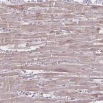 C3orf1 Antibody in Immunohistochemistry (Paraffin) (IHC (P))