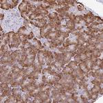 DOK4 Antibody in Immunohistochemistry (Paraffin) (IHC (P))