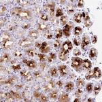 SP140L Antibody in Immunohistochemistry (Paraffin) (IHC (P))