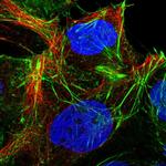 CYP20A1 Polyclonal Antibody