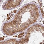 CYP20A1 Antibody in Immunohistochemistry (IHC)