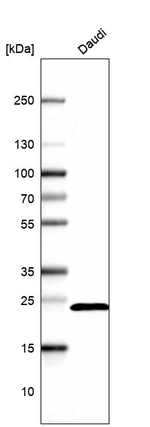 RPS5 Antibody in Western Blot (WB)
