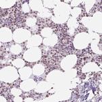 CD179a Antibody in Immunohistochemistry (Paraffin) (IHC (P))
