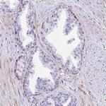 FAM107A Antibody in Immunohistochemistry (IHC)