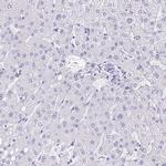 FAM107A Antibody in Immunohistochemistry (IHC)
