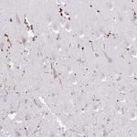FAM107A Antibody in Immunohistochemistry (IHC)