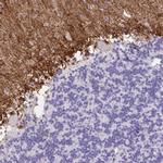 FAM107A Antibody in Immunohistochemistry (IHC)