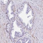 FAM107A Antibody in Immunohistochemistry (IHC)