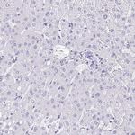 FAM107A Antibody in Immunohistochemistry (IHC)