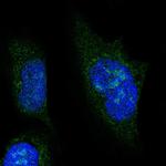 NOL6 Polyclonal Antibody