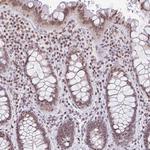 NOL6 Antibody in Immunohistochemistry (Paraffin) (IHC (P))