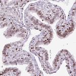 Histone H1.2 Polyclonal Antibody