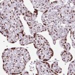 Histone H1.2 Antibody in Immunohistochemistry (Paraffin) (IHC (P))
