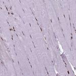 Histone H1.2 Antibody in Immunohistochemistry (Paraffin) (IHC (P))
