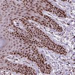 Histone H1.2 Antibody in Immunohistochemistry (Paraffin) (IHC (P))