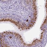 LCN10 Polyclonal Antibody