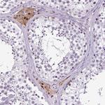 TAFA3 Antibody in Immunohistochemistry (Paraffin) (IHC (P))