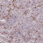 TAF1D Antibody in Immunohistochemistry (Paraffin) (IHC (P))