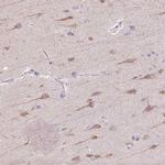 TMEM100 Antibody in Immunohistochemistry (Paraffin) (IHC (P))