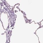 TMEM100 Antibody in Immunohistochemistry (Paraffin) (IHC (P))