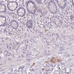TMEM100 Antibody in Immunohistochemistry (Paraffin) (IHC (P))
