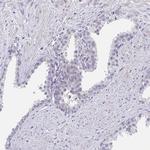 CRACC Antibody in Immunohistochemistry (Paraffin) (IHC (P))