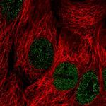 PLCXD2 Polyclonal Antibody