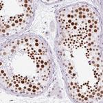 PLCXD2 Antibody in Immunohistochemistry (Paraffin) (IHC (P))
