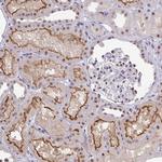 OR6K3 Antibody in Immunohistochemistry (Paraffin) (IHC (P))