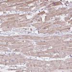 CDRT15 Polyclonal Antibody