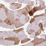 NUDT3 Polyclonal Antibody