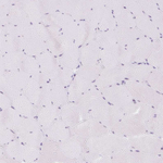 SPRR4 Antibody in Immunohistochemistry (Paraffin) (IHC (P))