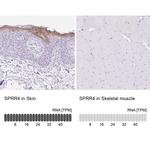 SPRR4 Antibody in Immunohistochemistry (IHC)