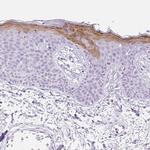SPRR4 Antibody in Immunohistochemistry (IHC)