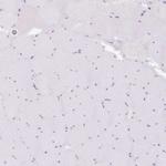 SPRR4 Antibody in Immunohistochemistry (IHC)
