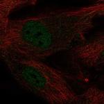 KLF2 Antibody in Immunocytochemistry (ICC/IF)