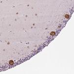 HABP4 Antibody in Immunohistochemistry (Paraffin) (IHC (P))