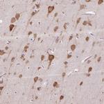 HABP4 Antibody in Immunohistochemistry (Paraffin) (IHC (P))
