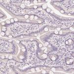 HABP4 Antibody in Immunohistochemistry (Paraffin) (IHC (P))